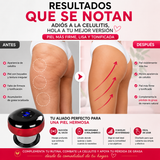 Masajeador de Ventosas Anticelulitis Recargable