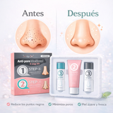 Kit 3 en 1 Anti-Puntos Negros de 3 Pasos ORIGINAL -  EN SU NUEVA PRESENTACION