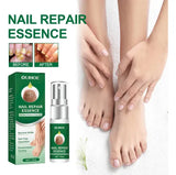 OFERTA 2X1 - Spray Reparador de Uñas Anti-Hongos