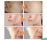 Kit X 5 Rutina Facial BIOAQUA ORIGINAL