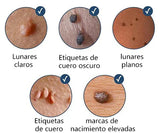Eliminador de Verrugas y Lunares Wart Remover™ Elimina Con Suavidad y Rapidez