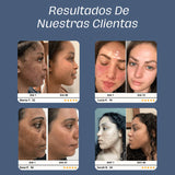 Skin Glow 3.0™ El Mejor Aliado Para Tu Piel