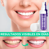 OFERTA 2x1 - BLANQUEADOR DENTAL DentistPRO v34®️